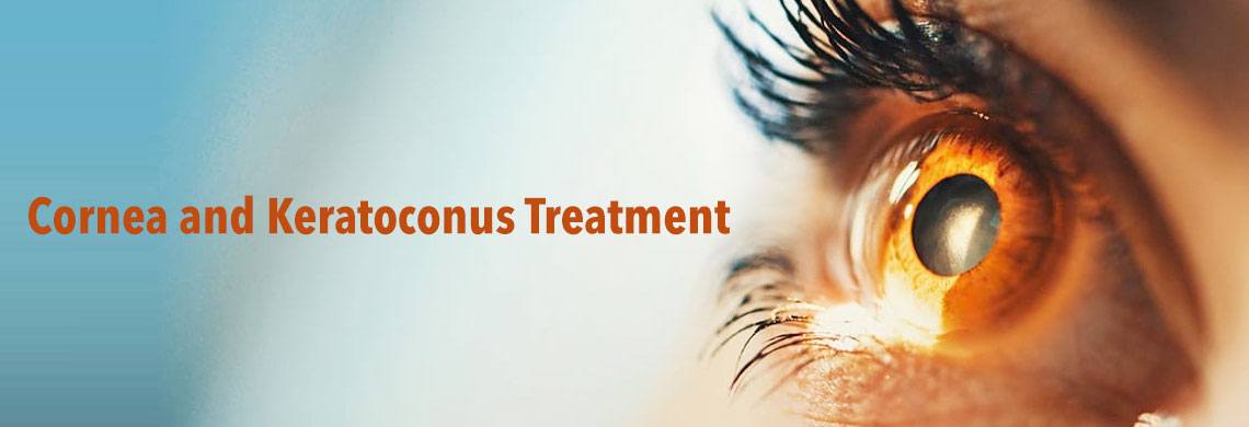 What are the treatments for keratoconus?