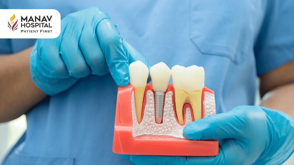Root Canal Treatment in Ghaziabad