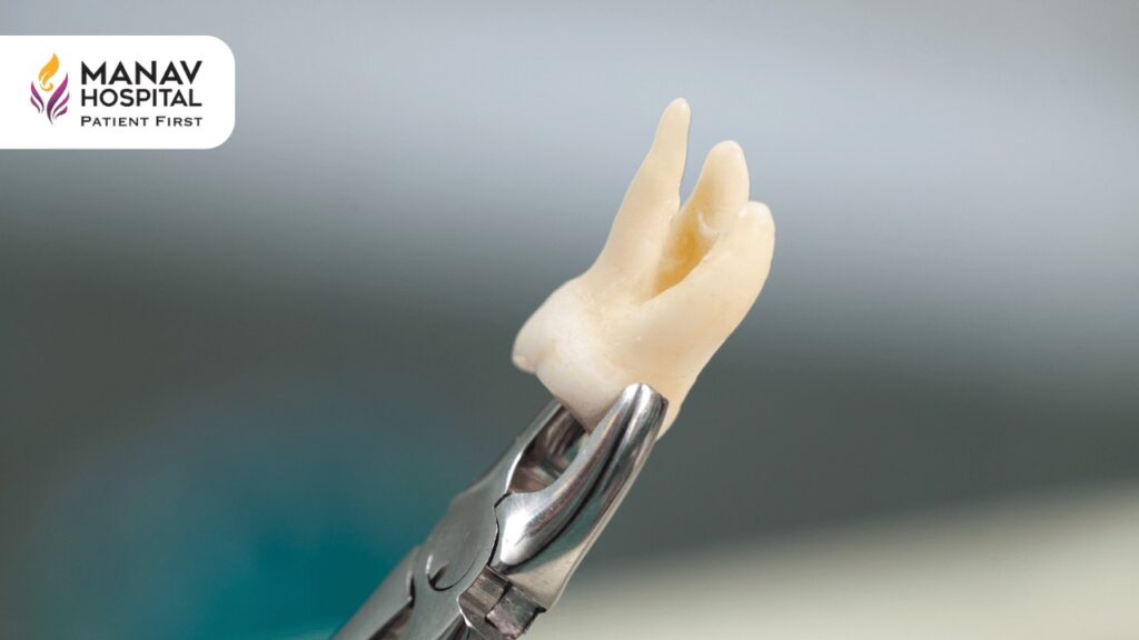 Best Wisdom Tooth Extraction Hospital in Ghaziabad