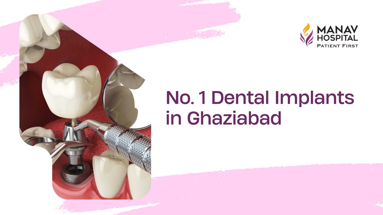 Dental Implants in Ghaziabad
