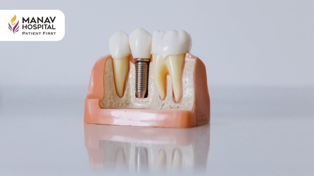 Root Canal Treatment in Ghaziabad