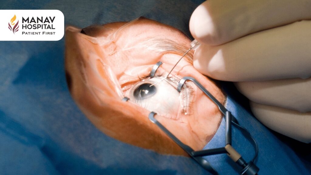 Best Cataract Surgery Hospital in Ghaziabad