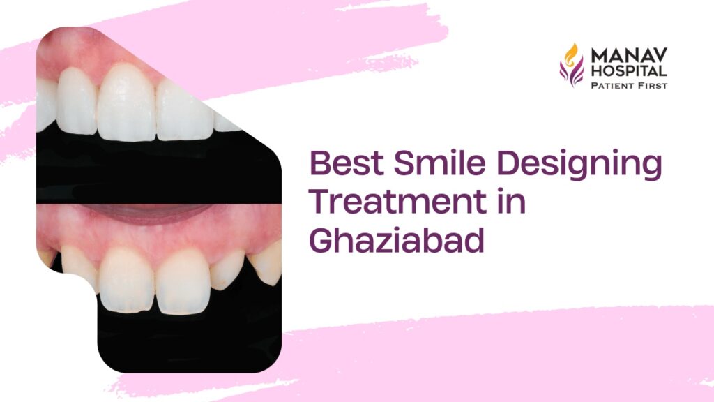 Smile Design in Ghaziabad