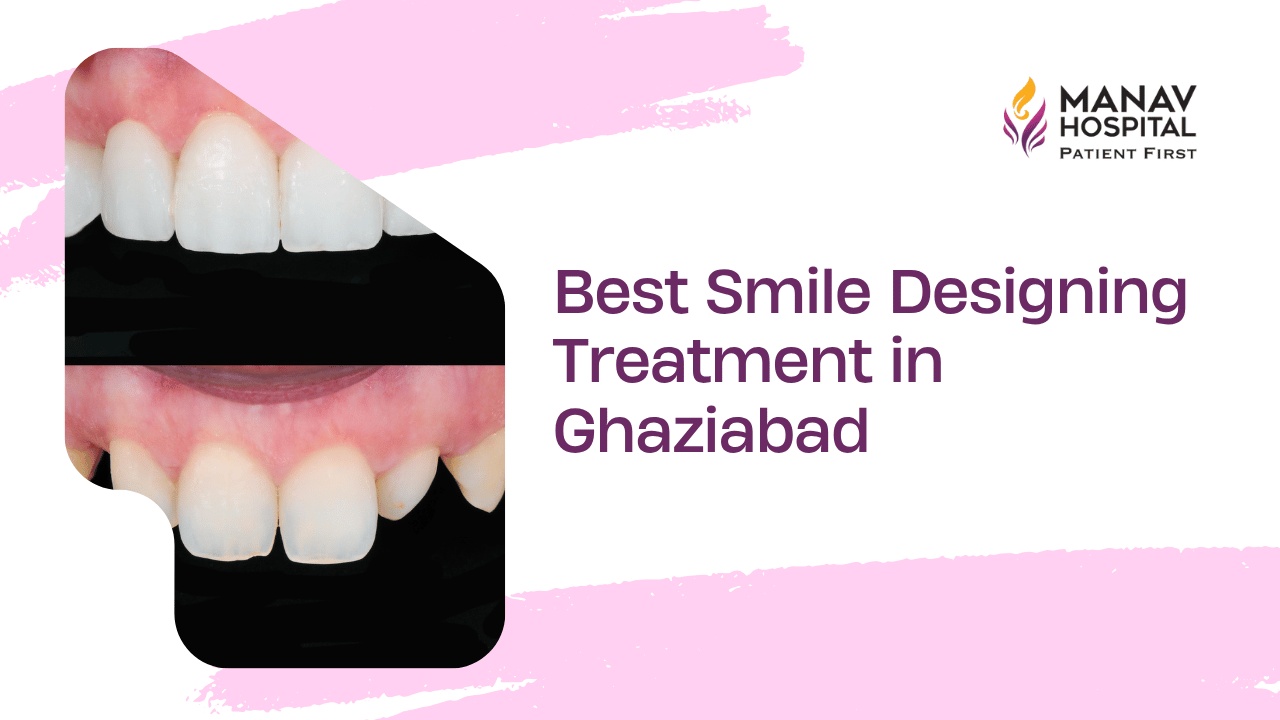 Smile Design in Ghaziabad