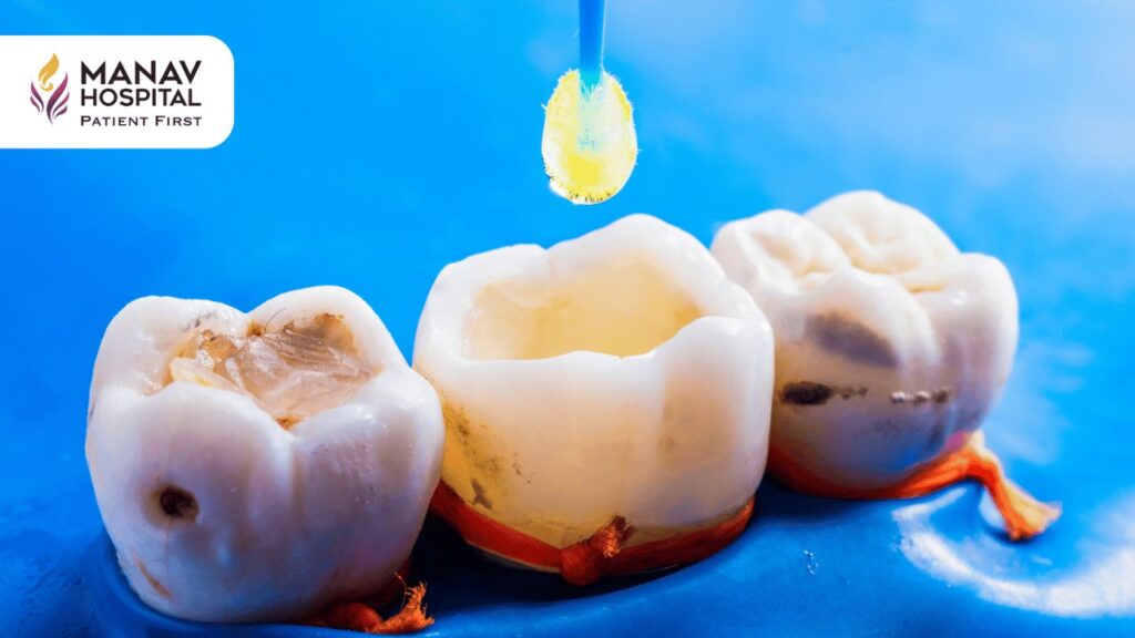 Find Best Dental Fillings Doctors in Ghaziabad