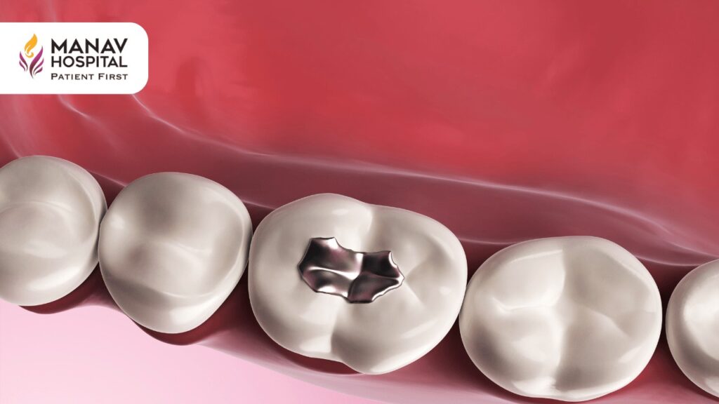 Find Best Dental Fillings Doctors in Ghaziabad