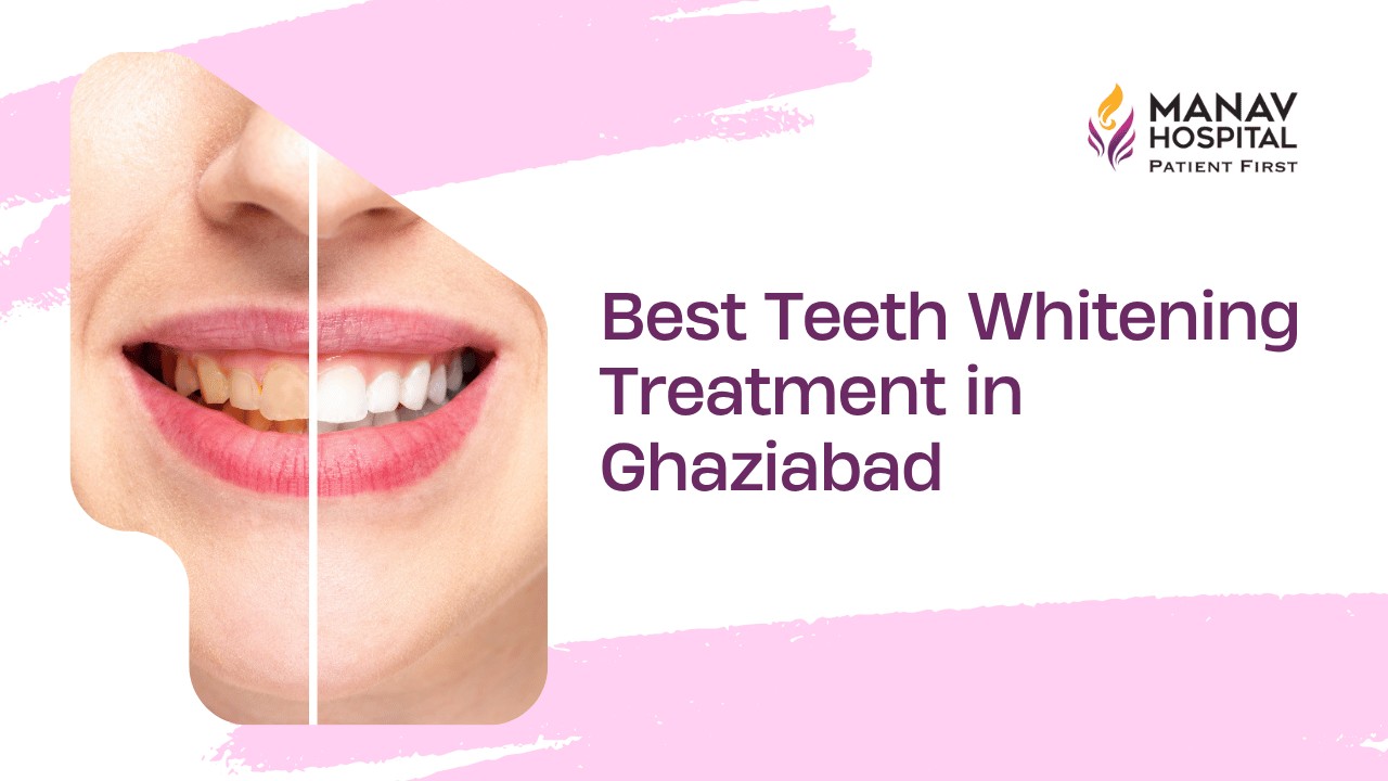 Teeth Whitening in Ghaziabad