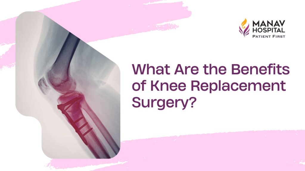 Knee Replacement Surgery