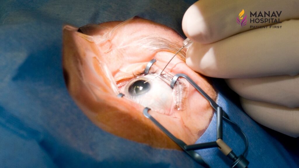 Cataract surgery consultation at Manav Hospital in Ghaziabad
