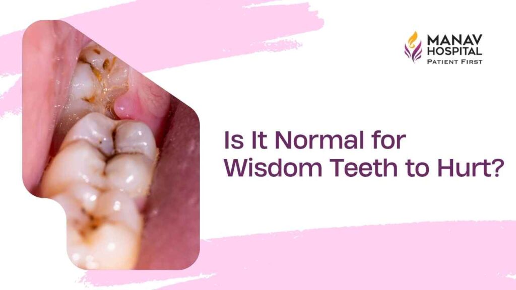 Wisdom tooth pain consultation with Dr. Kanika Gupta at Manav Hospital in Ghaziabad
