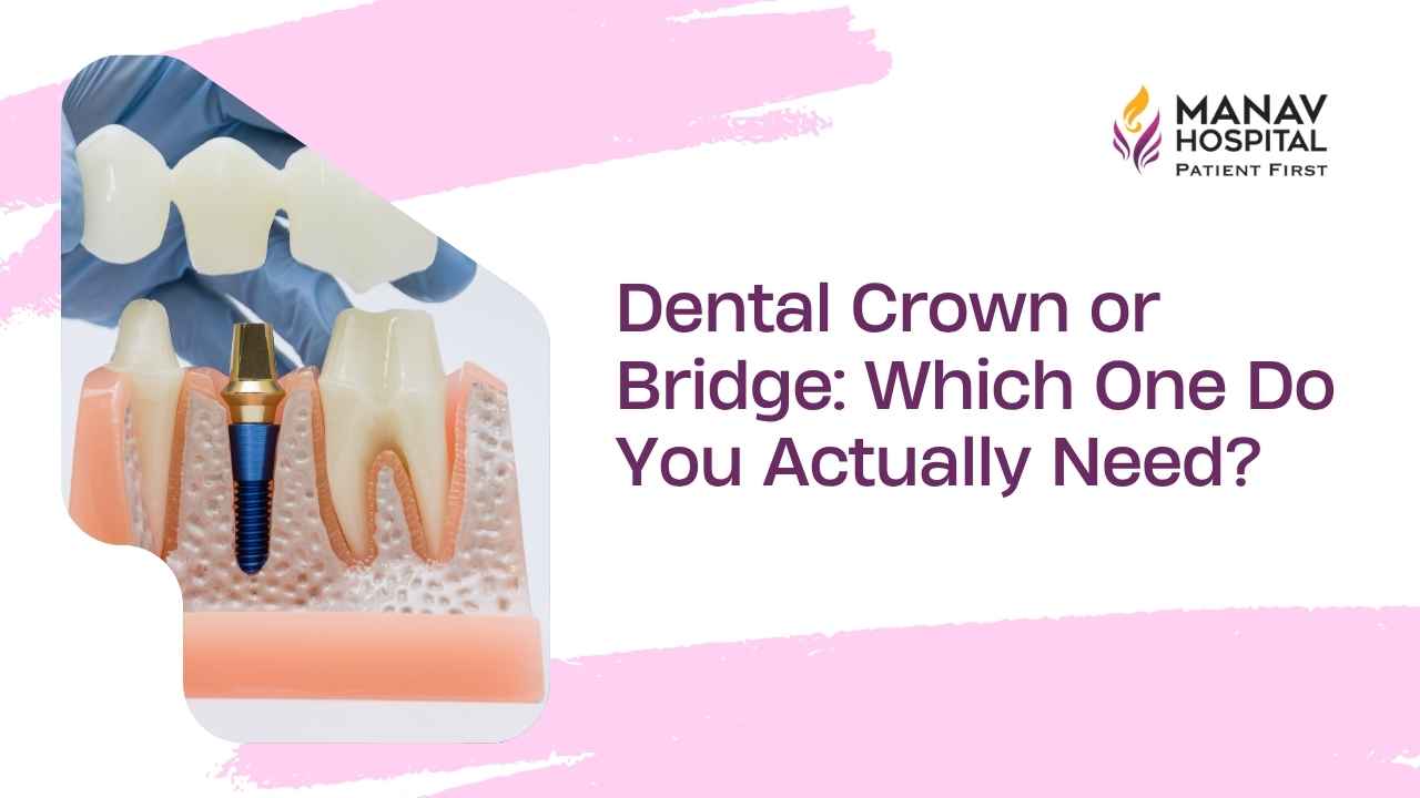 Dental crown or bridge consultation with Dr. Kanika Gupta at Manav Hospital in Ghaziabad
