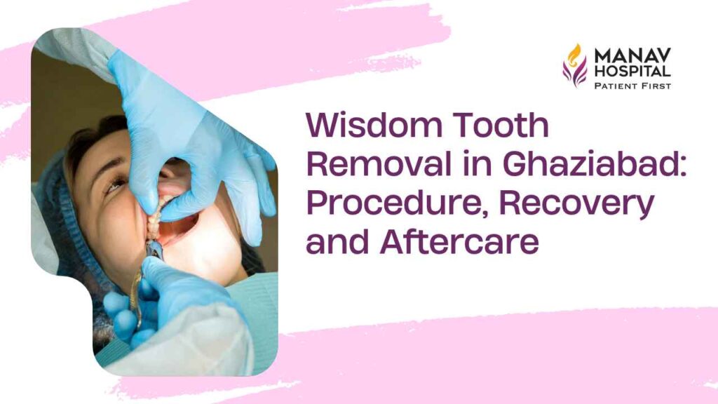 Wisdom tooth removal procedure in Ghaziabad